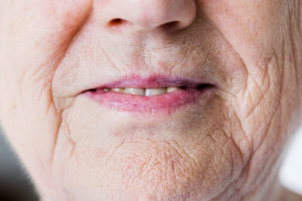 Das Bild zeigt den Mund und das Lächeln einer älteren Frau.
