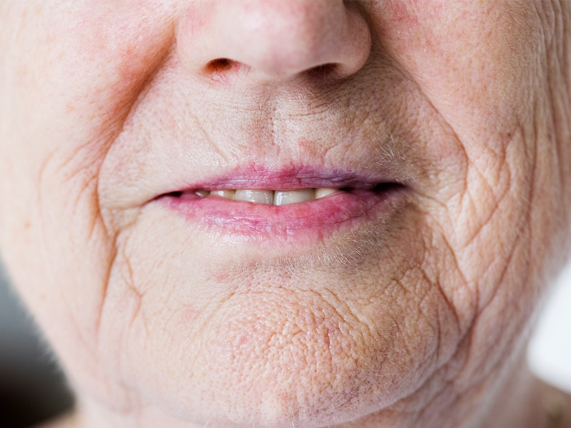 Das Bild zeigt den Mund und das Lächeln einer älteren Frau.