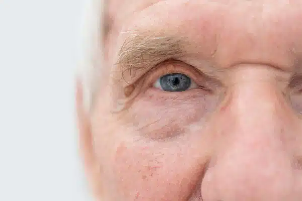 Das Bild zeigt eine Nahaufnahme des Gesichts und der Augen eines älteren Mannes.