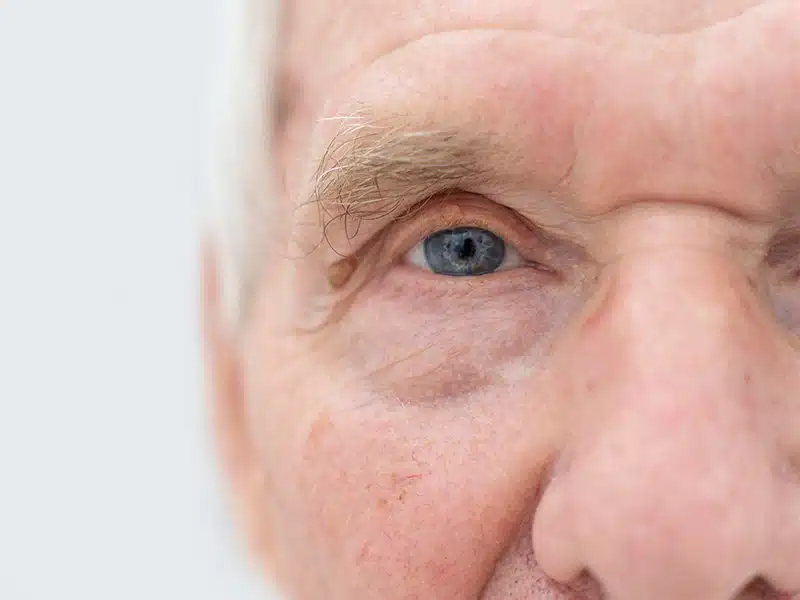 Das Bild zeigt eine Nahaufnahme des Gesichts und der Augen eines älteren Mannes.